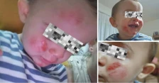 „Кучето ми го повлече малото дете од раце“: Мајка и две деца од кичевско нападнати од агресивни кучиња, повикува на одговорност