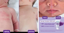Becutan Sensitive SOS: Нежна формула за смирување и заштита на чувствителната кожа на најмалите