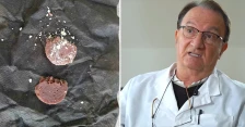 Д-р Чибишев со предупредување откако деца пронашле салама со отров во парк во Скопје