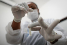 Експертите предупредуваат за нова епидемија: Вирусот Нипа се шири во Индија, вакцината сè уште не е достапна