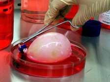 Стартапот поддржан од милијардери сака да одгледува „вреќи за органи“ без глава од луѓе за да го замени тестирањето врз животни