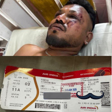 Единствениот преживеан во авионската несреќа на Ер Индија во која загинаа 241 лице: „Не сакам да разговарам со никого“ - Либертас