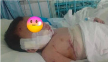 (Видео) Тешка е здравствената состојба на двегодишникот искасан од куче - Либертас