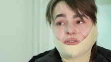 (Видео) Исповед на преживеана од „Пулс“: По комата започна борбата за живот, а денес сфаќам дека ништо не вреди ако не си здрав - Либертас