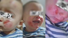ФОТО: Домашни расни кучиња нападнале мајка со малолетни деца во кичевско, едното дете има повреди по лицето! - Либертас