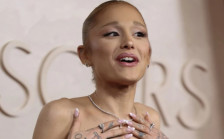 (Фото) Сè повеќе загрижува со својот изглед, но тврди дека сè е во ред: „Помогнете ѝ“