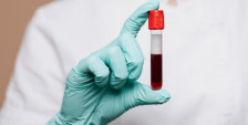 Истражувачи од Велика Британија работат на тест на крвта што би можел да предвиди болести до 10 години однапред