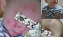 Ротвајлери нападнале мајка со две деца во кичевско Другово