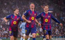 Левандовски со скршена очна шуплина го пропушта дербито против Атлетико Мадрид! - SportStation.mk