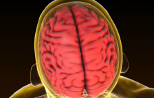 Граѓаните со голем интерес на бесплатните прегледи по повод Светскиот ден на мозочен удар - telma.com.mk