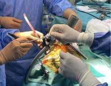 Меѓународната еспертиза ќе почека да заврши бирократијата околу ангажманот на лекарите во скандалот со непотребните операции на срце - telma.com.mk