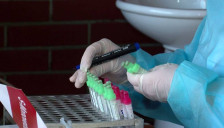 За една недела пријавени 314 случаи на грип, надлежните велат - земјата се уште не влегла во сезоната на грип - telma.com.mk