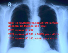 Повторно сериозен пораст на заболени од карцином на бели дробови, нови 6 илјади болни за една година - telma.com.mk